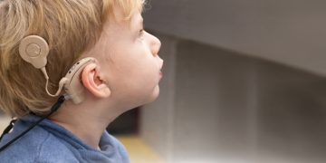 25 Φεβρουαρίου – Παγκόσμια Ημέρα Κοχλιακών Εμφυτευμάτων